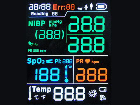 STN YG ST7565R 7-segmentowy ekran LCD Monochromatyczny 128X64 punktów Lutowanie FPC